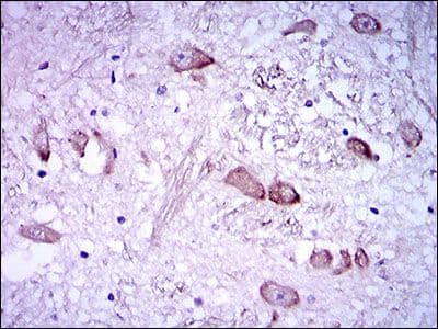 NEFH / NF-H Antibody (Amino Acid: 968-1020, clone 8H10)