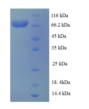 Human AKT1 Protein (Recombinant GST)