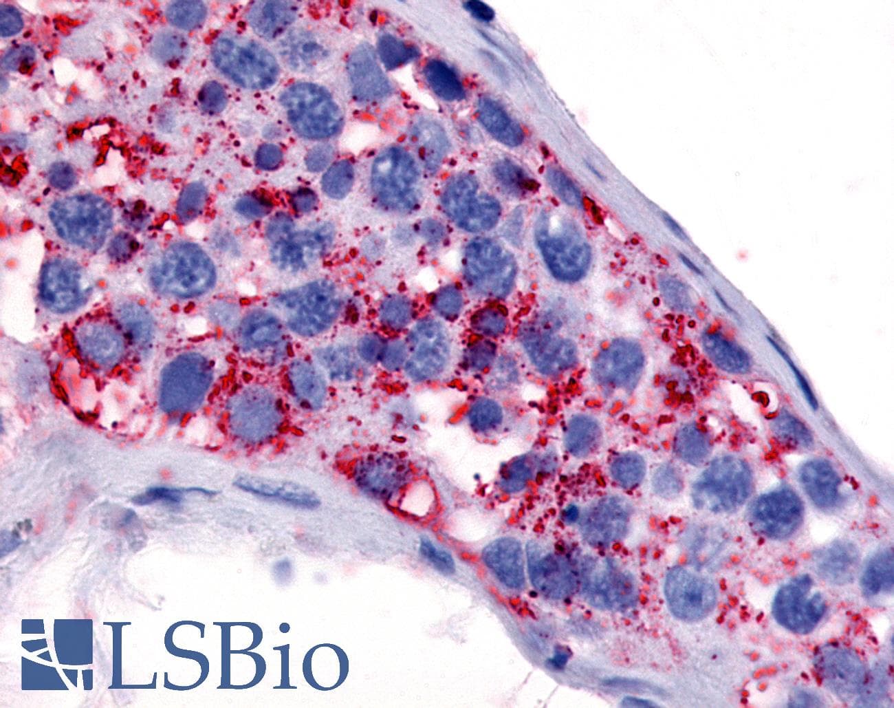 IHC-plus™ HTR1E / 5-HT1E Receptor Antibody (Cytoplasmic Domain)