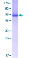 Human ANXA2 / Annexin A2 Protein (Recombinant GST)