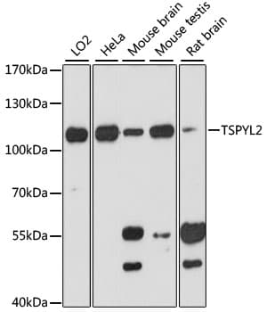 Polyclonal Rabbit anti-Human TSPYL2 / DENTT Antibody (WB)