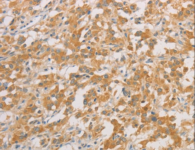 Polyclonal Rabbit anti-Human ZWINT Antibody (IHC)