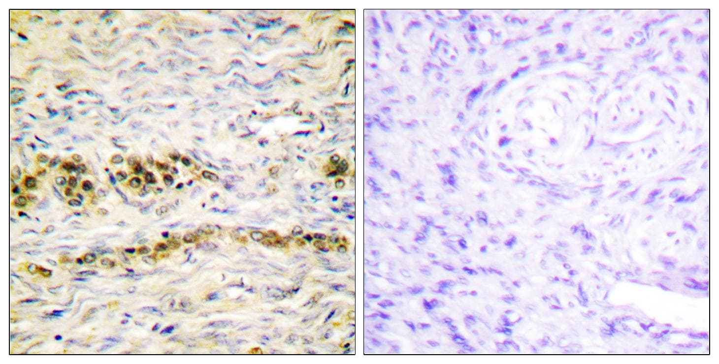 AKT1 Antibody (phospho-Tyr474)