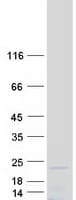 Human RPL35 / Ribosomal Protein L35 (Recombinant Myc-DDK (Flag))