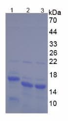 Human HMGN2 Protein (Recombinant His, N-Terminal)