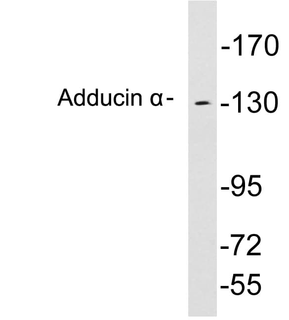 ADD1 / Adducin Alpha Antibody (aa432-481)