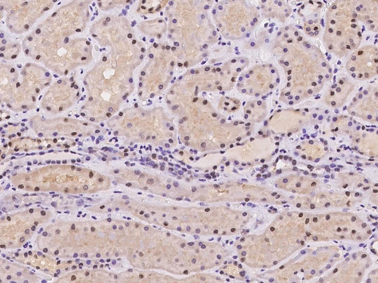 LONP2 / LONP Antibody