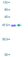 Human FTL / Ferritin Light Chain Protein (Recombinant GST)