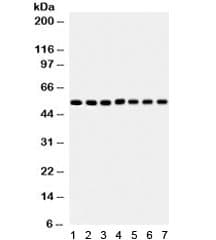 SMAD1+2+3+4+5 Antibody