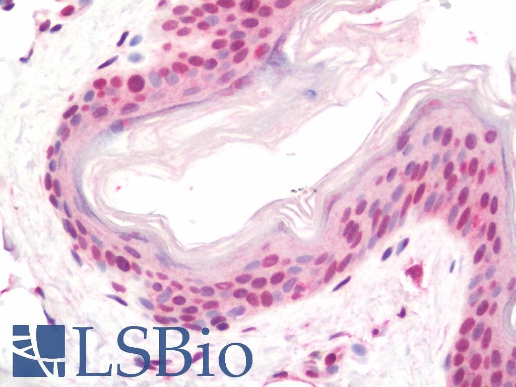 IHC-plus™ AKT3 Antibody (aa88-118)