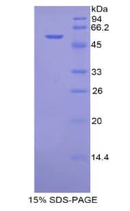 Mouse FUS / TLS Protein (Recombinant His, N-Terminal)