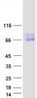 Human CSF2RA / CD116 Protein (Recombinant Myc-DDK (Flag))
