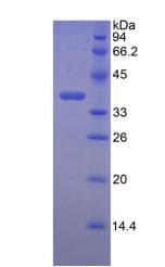 Mouse Lumican Protein (Recombinant His)