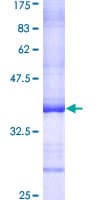 Human CEP250 / C-NAP1 Protein (Recombinant GST, N-terminus)