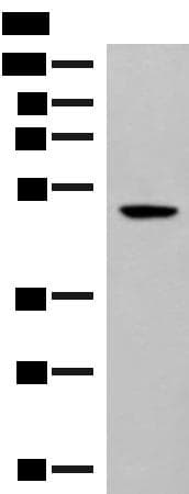 GPR142 Antibody