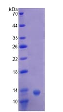 Human Complement C4b Protein (Recombinant His, N-Terminal)