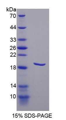 Human PDPN / Podoplanin Protein (Recombinant His-T7)