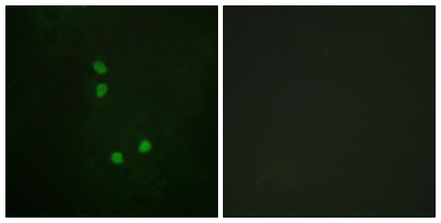 CCNE2 / Cyclin E2 Antibody (phospho-Thr392)