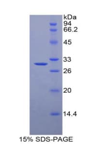 Pig A2M / Alpha-2-Macroglobulin Protein (Recombinant His)