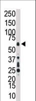 MAP3K7 / TAK1 Antibody (aa574-606)