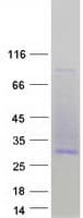 Human CD53 Protein (Recombinant Myc-DDK (Flag))
