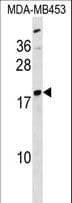 Polyclonal Rabbit anti-Human LYPLA1 Antibody (aa65-94, WB)