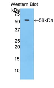 BTK Antibody (aa396-659)