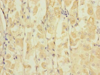 GRIK3 / GLUR7 Antibody