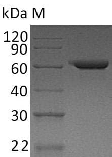 Human FN1 / Fibronectin Protein (Recombinant)