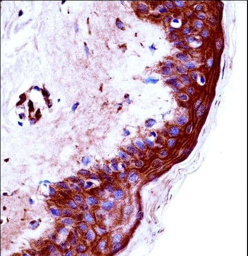 IHC-plus™ KLK9 / Kallikrein 9 Antibody (aa82-111)