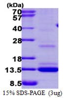 Human MGP / Matrix Gla-Protein (Recombinant 6His, N-terminus)