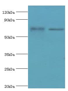 Polyclonal Rabbit anti-Human MTMR14 Antibody (aa1-280, IHC, WB)