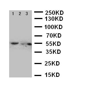 Polyclonal Rabbit anti-Mouse SLC2A5 / GLUT5 Antibody (aa232-251, IHC, WB)