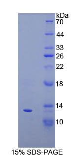 Bovine CXCL10 / IP-10 Protein (Recombinant His-T7)
