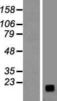 Human Gastrin Releasing Peptide Protein (Over-Expression Lysate Myc-DDK (Flag))
