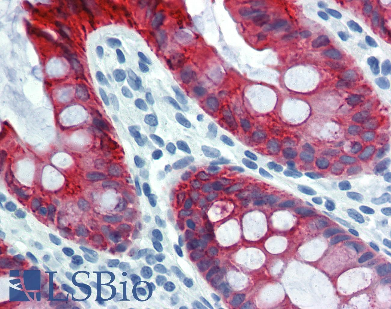 PathPlus™ Monoclonal Mouse anti-Human KRT18 / CK18 / Cytokeratin 18 Antibody (clone DC-10, IHC, WB)