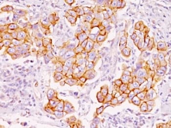 Monoclonal Mouse Phosphotyrosine Antibody (clone PY793, IHC, IF)