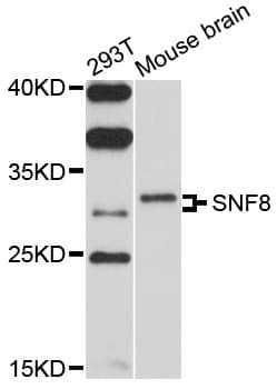 SNF8 / EAP30 Antibody