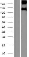 Human LEPR / Leptin Receptor Protein (Over-Expression Lysate Myc-DDK (Flag))