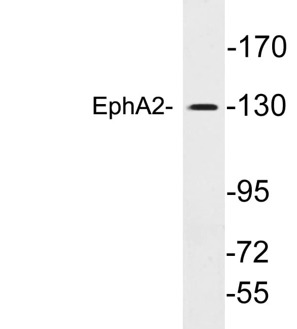 Polyclonal Rabbit anti-Human EPHA2 / EPH Receptor A2 Antibody (aa729-778, WB)