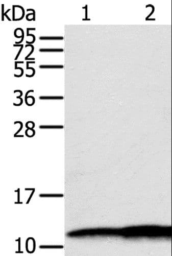 Polyclonal Rabbit anti-Human Calgizzarin / S100A11 Antibody (IHC, WB)