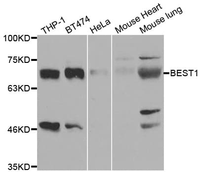 Polyclonal Rabbit anti-Human BEST1 / BEST / Bestrophin Antibody (WB)