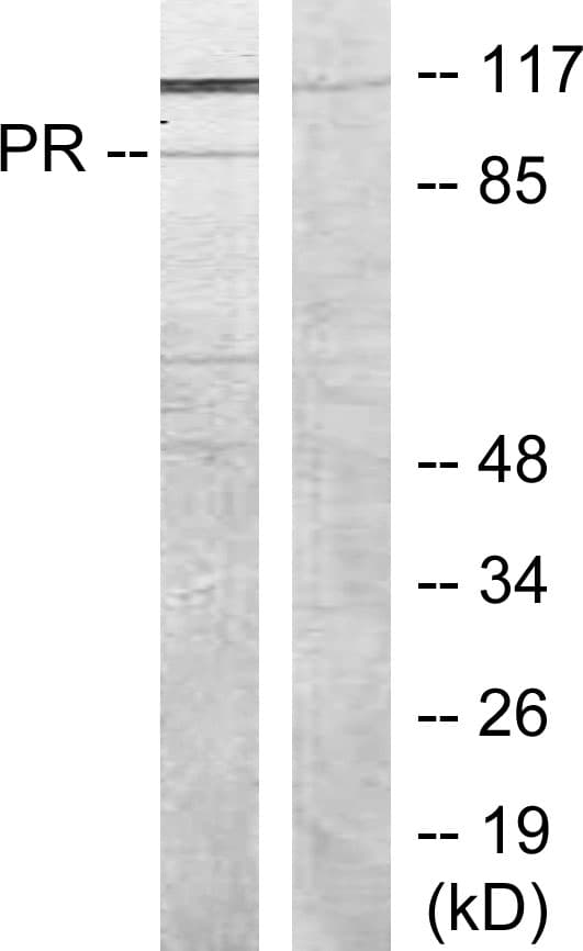 PR / Progesterone Receptor Antibody (aa161-210)