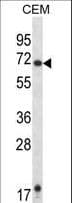 Polyclonal Rabbit anti-Human HRH1 / Histamine H1 Receptor Antibody (aa273-301, IHC, WB)