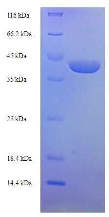 Trichosanthes kirilowii Karasurin-C Protein (Recombinant His-SUMO)