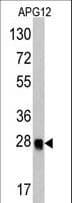 APG12 / ATG12 Antibody