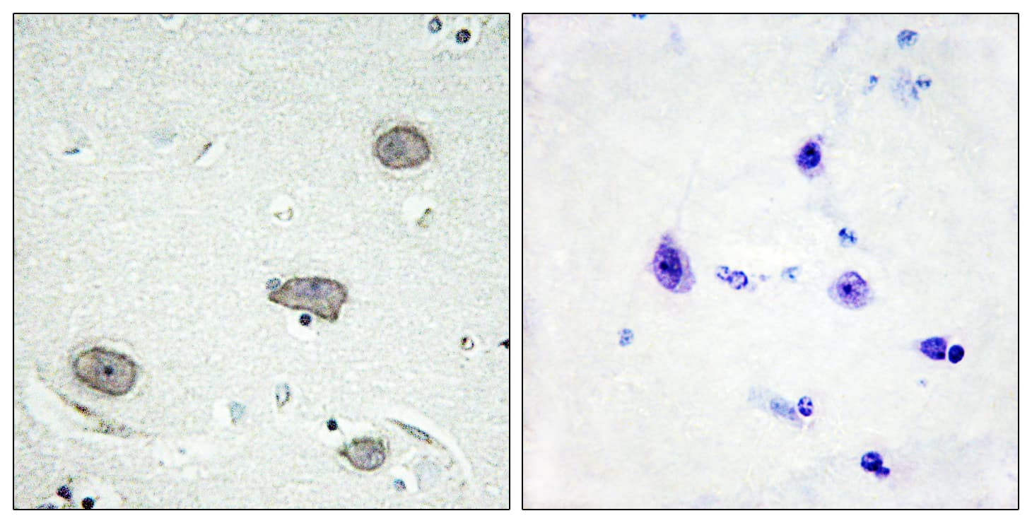 CSF1R / CD115 / FMS Antibody (phospho-Tyr809)