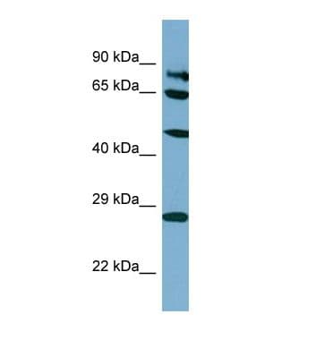 SV2B Antibody (aa439-488)