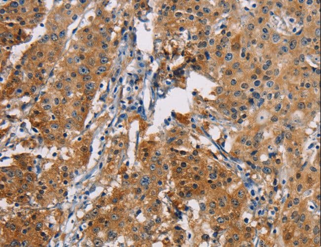 Polyclonal Rabbit anti-Human PD-L2 / PDCD1LG2 / CD273 Antibody (IHC)