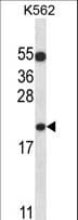 BAX Antibody (aa28-56)